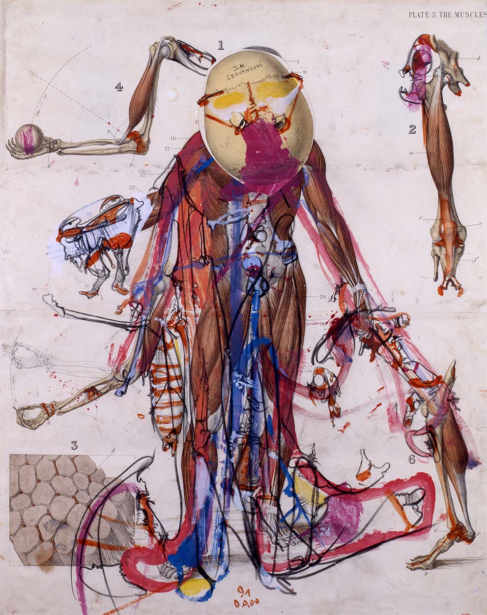 Collage de Dado : G. N. Servandoni, 1991