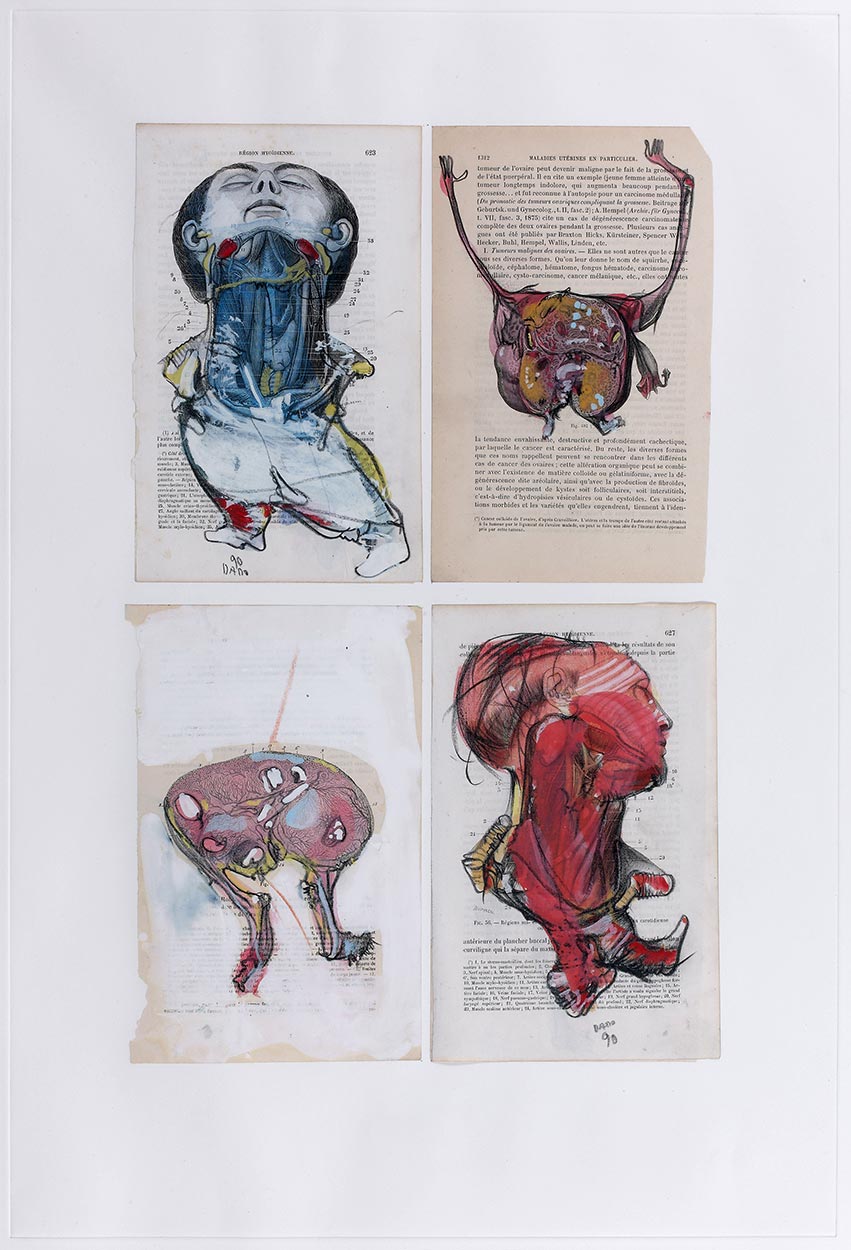 Collage de Dado :Anatomie, 1990